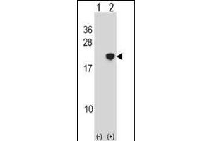 Western blot analysis of NANOS2 (arrow) using rabbit polyclonal NANOS2 Antibody (Center) (ABIN1538503 and ABIN2849951). (NANOS2 antibody  (AA 58-85))