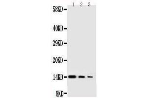 Anti-human NGF antibody, Western blotting Lane 1: Recombinant Human NGFB Protein 10ng Lane 2: Recombinant Human NGFB Protein 5ng Lane 3: Recombinant Human NGFB Protein 2 (Nerve Growth Factor antibody  (AA 122-241))