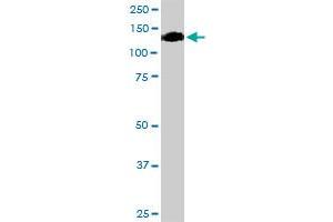 OSMR MaxPab rabbit polyclonal antibody. (Oncostatin M Receptor antibody  (AA 1-342))