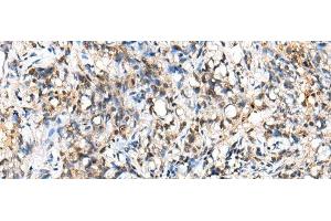 NUDT18 antibody
