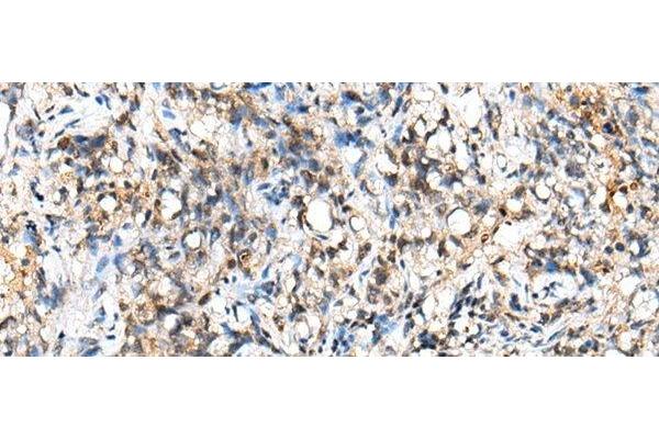 NUDT18 antibody