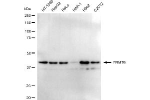 Western blotting analysis using PRMT6 antibody (ABIN7799972). (Recombinant PRMT6 antibody)
