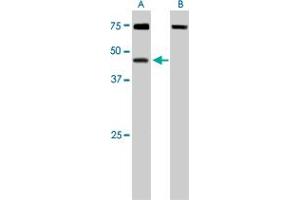 DYX1C1 polyclonal antibody  staining (0.