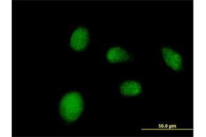 Immunofluorescence of purified MaxPab antibody to NANP on HeLa cell. (NANP antibody  (AA 1-248))