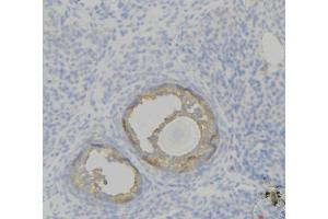 ABIN6276821 at 1/100 staining Human uterus tissue by IHC-P. (F12 antibody  (C-Term))