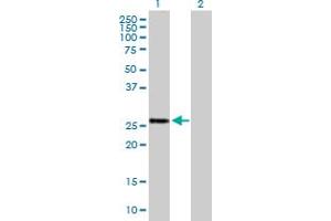 Western Blot analysis of BTG4 expression in transfected 293T cell line by BTG4 MaxPab polyclonal antibody. (BTG4 antibody  (AA 1-206))