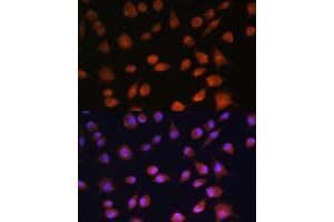 Immunofluorescence analysis of L929 cells using RPS19BP1 antibody (ABIN6132999, ABIN6147207, ABIN6147208 and ABIN6217154) at dilution of 1:100. (RPS19BP1 antibody  (AA 1-136))