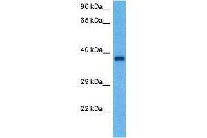 Host:  Rabbit  Target Name:  GAPDH  Sample Tissue:  Rat Brain  Antibody Dilution:  1ug/ml (GAPDH antibody  (Middle Region))