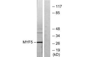 Western blot analysis of extracts from HepG2 cells, using MYF5 antibody. (MYF5 antibody  (Internal Region))