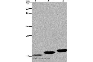Western blot analysis of Mouse skeletal muscle, heart and bladder tissue, using MYL12B Polyclonal Antibody at dilution of 1:450 (MYL12B antibody)