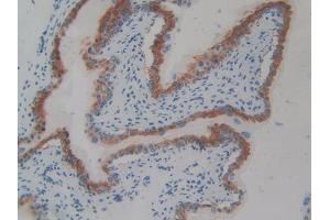 DAB staining on IHC-P; Samples: Mouse Vas Deferens Tissue