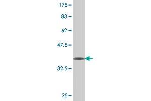 Western Blot detection against Immunogen (36. (NMNAT2 antibody  (AA 208-307))