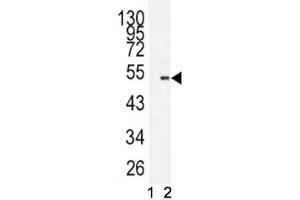 Western blot analysis of BMI1 antibody antibody and 293 lysate in the presence (1) and absence (2) of immunizing peptide. (BMI1 antibody  (AA 257-286))