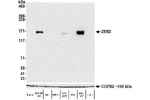 Western Blotting (WB) image for anti-Zinc Finger E-Box Binding Homeobox 2 (ZEB2) (AA 1164-1214) antibody (ABIN7453993)