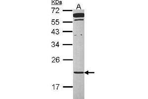 WB Image Sample (30 ug of whole cell lysate) A: Raji 12% SDS PAGE antibody diluted at 1:1000 (TMED2 antibody  (Center))