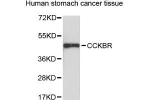 Western blot analysis of extracts of human stomach cancer tissue, using CCKBR antibody (ABIN1871507). (CCKBR antibody)