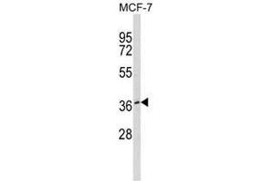 Western blot analysis of BMI1 Antibody in MDA-MB231 cell line lysates (35ug/lane). (BMI1 antibody)