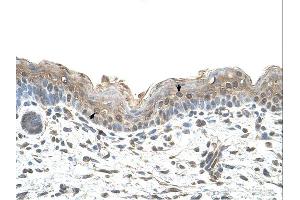 Ribophorin II antibody was used for immunohistochemistry at a concentration of 4-8 ug/ml.