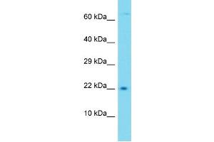 Western Blotting (WB) image for anti-Transmembrane Protein 52B (TMEM52B) (C-Term) antibody (ABIN2791294)