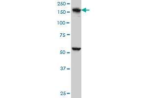 EEA1 monoclonal antibody (M02A), clone 1D4 Western Blot analysis of EEA1 expression in A-431 . (EEA1 antibody  (AA 1312-1411))