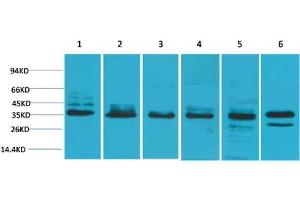 Western Blot (WB) analysis of 1) HeLa, 2) 293T, 3) C2C12, 4) Mouse Liver Tissue, 5) PC12, 6) Rat Brain Tissue with TBP Rabbit Polyclonal Antibody diluted at 1:2000. (TBP antibody)