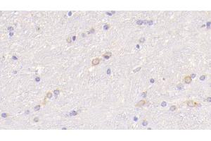 Detection of WNT5A in Mouse Cerebrum Tissue using Polyclonal Antibody to Wingless Type MMTV Integration Site Family, Member 5A (WNT5A) (WNT5A antibody  (AA 62-380))
