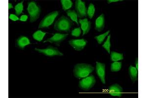 Immunofluorescence of monoclonal antibody to TXN on HeLa cell.