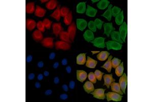 ABIN6262772 and ABIN6267008 staining Hela cells(45 min of heat-shock treatment) by IF/ICC. (KRT15 antibody  (N-Term))