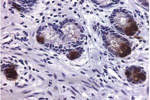 Immunohistochemistry (IHC) image for anti-Matrix Metallopeptidase 9 (Gelatinase B, 92kDa Gelatinase, 92kDa Type IV Collagenase) (MMP9) antibody (ABIN375617)