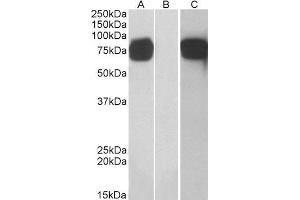 HEK293 lysate (10ug protein in RIPA buffer) overexpressing Human GOLM1 with C-terminal MYC tag probed with ABIN2562879 (1ug/ml) in Lane A and probed with anti-MYC Tag (1/1000) in lane C.