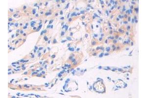 Used in DAB staining on fromalin fixed paraffin- embedded pancreas tissue (GAD antibody  (AA 1-97))