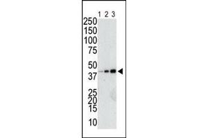 The anti-GST Pab (ABIN388090 and ABIN2843198) is used in Western blot to detect a GST-fusion recombinant protein (42 kDa) purified from bacterial lysate (Lanes 1-3: 10, 40, and 160 ng GST-fusion protein).