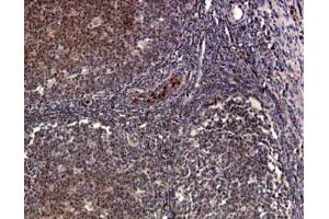 Immunohistochemistry (IHC) image for anti-Chemokine (C-C Motif) Receptor 1 (CCR1) (AA 7-24) antibody (ABIN342734) (CCR1 antibody  (AA 7-24))