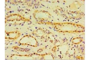 Immunohistochemistry of paraffin-embedded human kidney tissue using ABIN7148440 at dilution of 1:100 (CRX antibody  (AA 120-285))