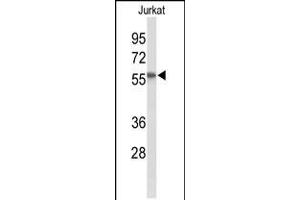 Western blot analysis of SACM1L Antibody in Jurkat cell line lysates (35ug/lane)
