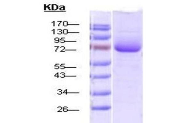 HSP70 Protein (His tag)