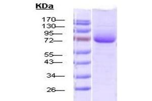 SDS-Page of endotoxin-free his-tagged 70 kDa human Hsp70 protein (ABIN1686687, ABIN1686688 and ABIN1686689). (HSP70 Protein (His tag))