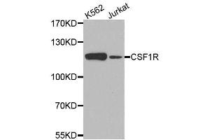 Western blot analysis of extracts of various cell lines, using CSF1R antibody. (CSF1R antibody)
