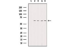 Western blot analysis of extracts from various samples, using TIGD2 Antibody. (TIGD2 antibody)