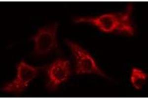 ABIN6275089 staining HeLa cells by IF/ICC. (MYLIP antibody  (Internal Region))