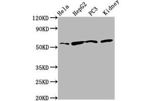 Western Blot Positive WB detected in: Hela whole cell lysate, HepG2 whole cell lysate, PC-3 whole cell lysate, Rat kidney tissue All lanes: TTI2 antibody at 8. (TTI2 antibody  (AA 159-264))