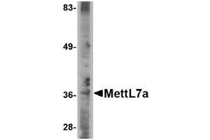 Image no. 1 for anti-Methyltransferase Like 7A (METTL7A) (C-Term) antibody (ABIN341690) (METTL7A antibody  (C-Term))