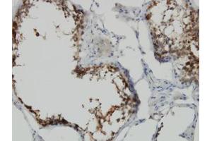 Image no. 1 for anti-POM121 and ZP3 Fusion (POMZP3) (AA 64-116) antibody (ABIN599186) (POMZP3 antibody  (AA 64-116))