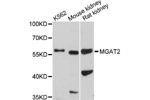 Western blot analysis of extracts of various cell lines, using MGAT2 antibody.