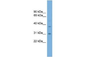 Western Blotting (WB) image for anti-Aryl Hydrocarbon Receptor Interacting Protein (AIP) (Middle Region) antibody (ABIN2787565)