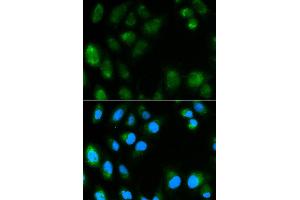Immunofluorescence analysis of MCF7 cell using UCP3 antibody. (UCP3 antibody)