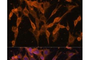 Immunofluorescence analysis of NIH/3T3 cells using UBQLNL Polyclonal Antibody at dilution of 1:100. (UBQLNL antibody)