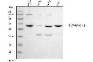 Western blot analysis of TMPRSS13 using anti-TMPRSS13 antibody (ABIN7599797). (TMPRSS13 antibody  (AA 118-572))