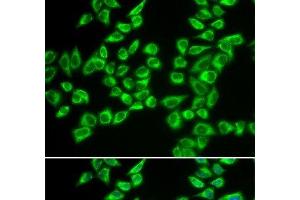 Immunofluorescence analysis of A549 cells using HADHB Polyclonal Antibody (HADHB antibody)