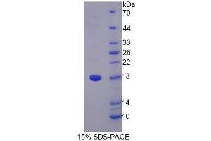 SDS-PAGE (SDS) image for Signal Transducer and Activator of Transcription 5A (STAT5A) (AA 673-773) protein (His tag) (ABIN1171374)